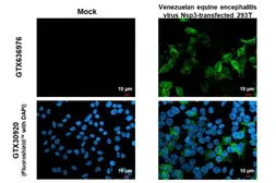 Anti-Venezuelan Equine Encephalitis Virus nsP3 antibody [HL1502] used in Immunocytochemistry/ Immunofluorescence (ICC/IF). GTX636976